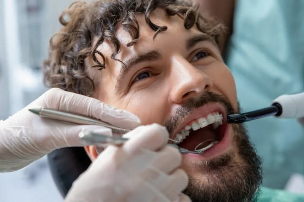 Dental Fillings