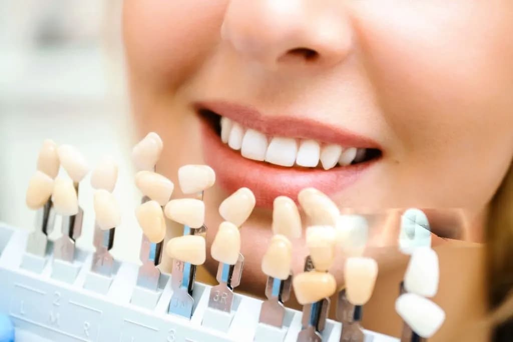 Permanent Teeth Replacement