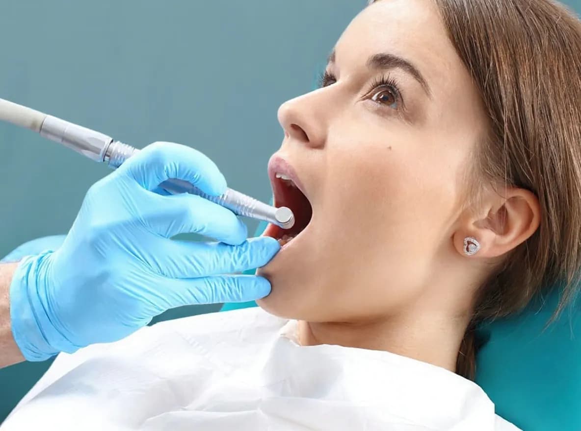 Root Canal